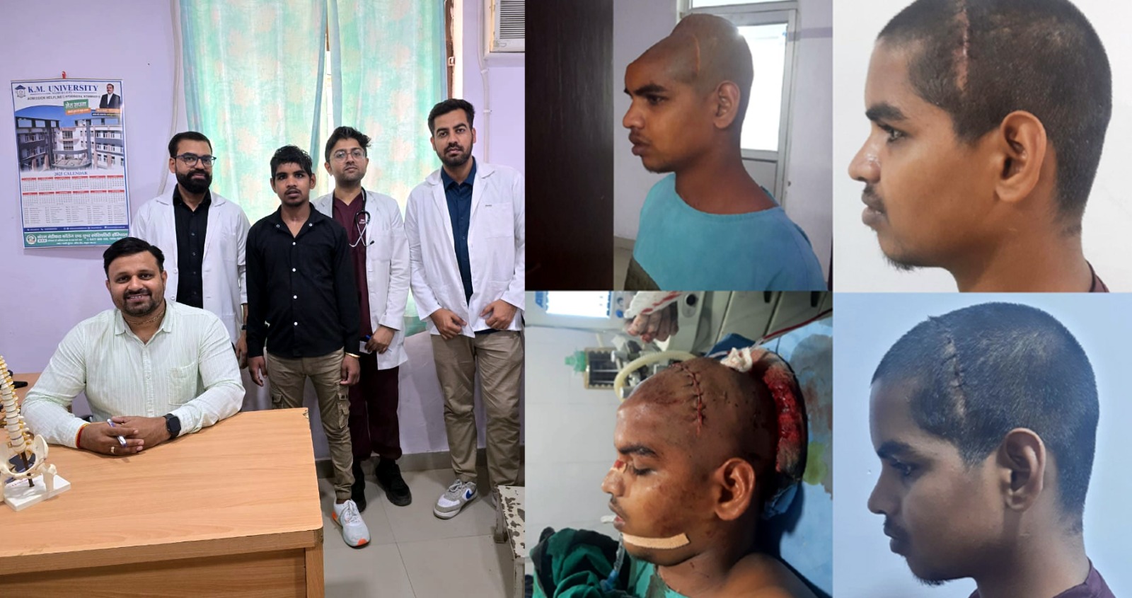 न्यूरो सर्जन ने अपनी टीम के साथ नवीन का किया पुनः दिमाग सहित सिर का ऑपरेशन,   मरीज के परिजनों ने जिला पंचायत अध्यक्ष सहित केएम के न्यूरो सर्जरी टीम का जताया आभार